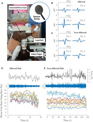 Motor Unit Activity during Fatiguing Isometric Muscle Contraction in Hemispheric Stroke Survivors